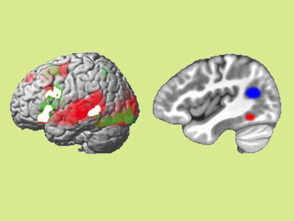 Linguagem estampada no cérebro